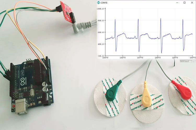 ECG monitor integration and IoT-based remote monitoring