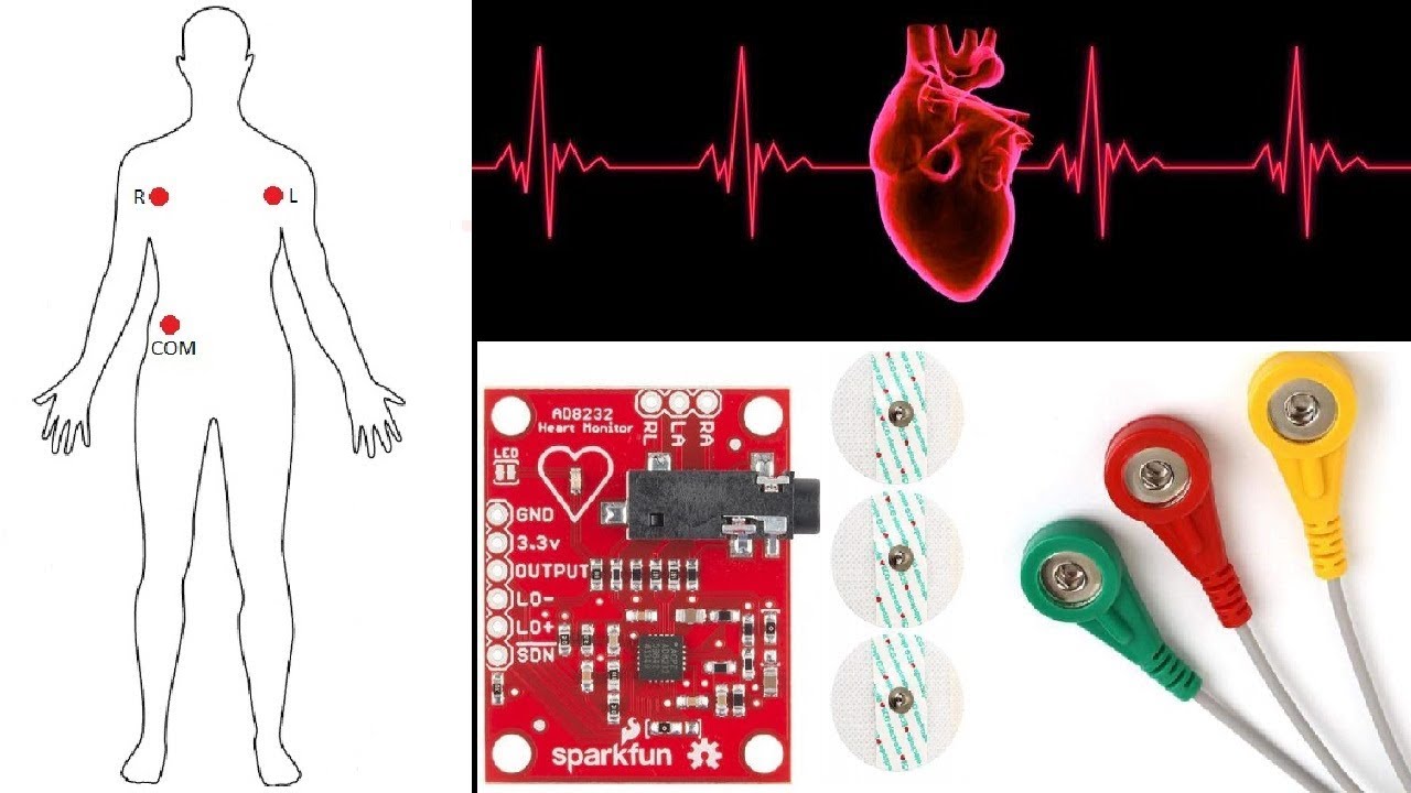 Seamless ECG Monitor & IoT Device Integration